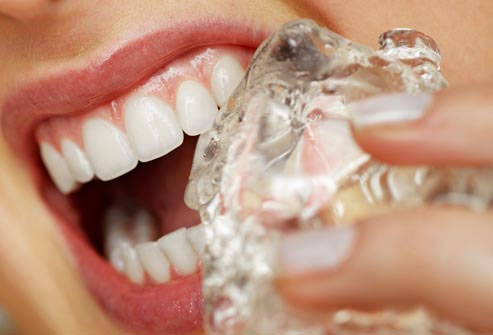 Cómo combatir la sensibilidad dental