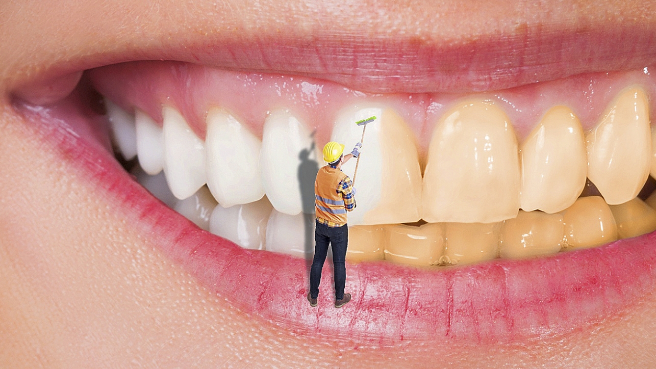 5 razones para realizarse un blanqueamiento dental